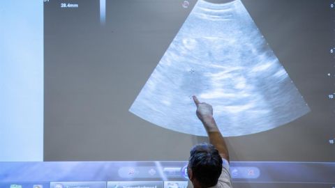 Ecografía de osezno